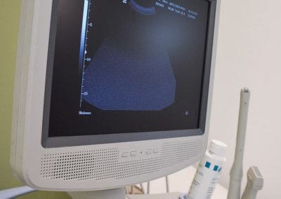 Monitor Sonogerät